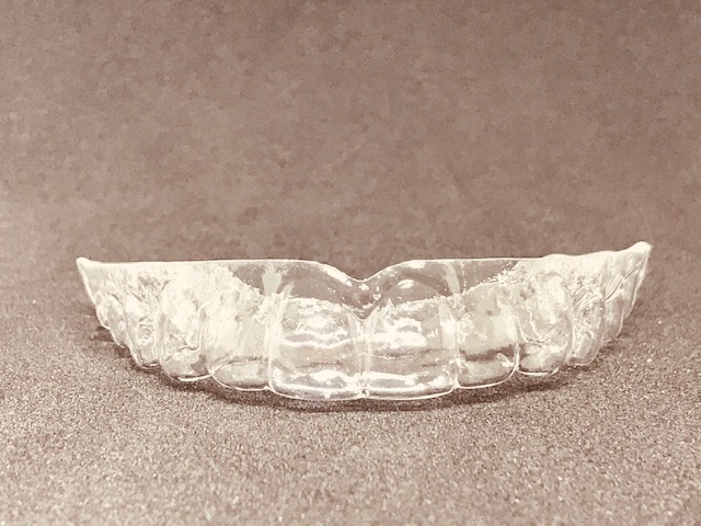 Активная каппа (с переносом до 4 зубов)