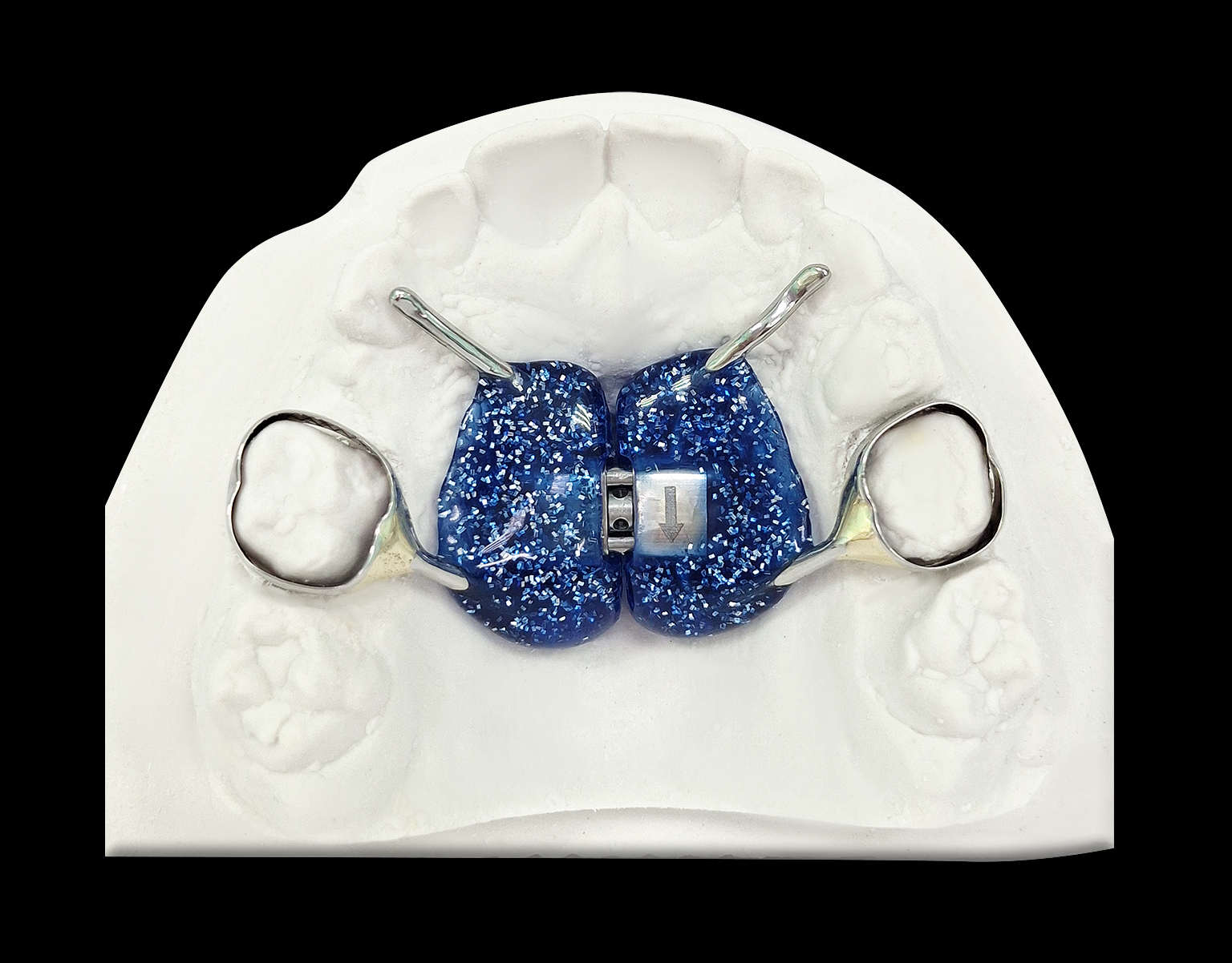 Аппарат Хаас  (Марко-Росса)