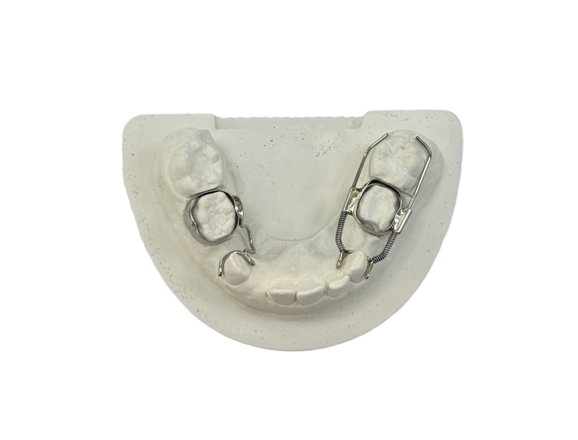 Распорка для зуба активная (с пружиной) на 1 кольце