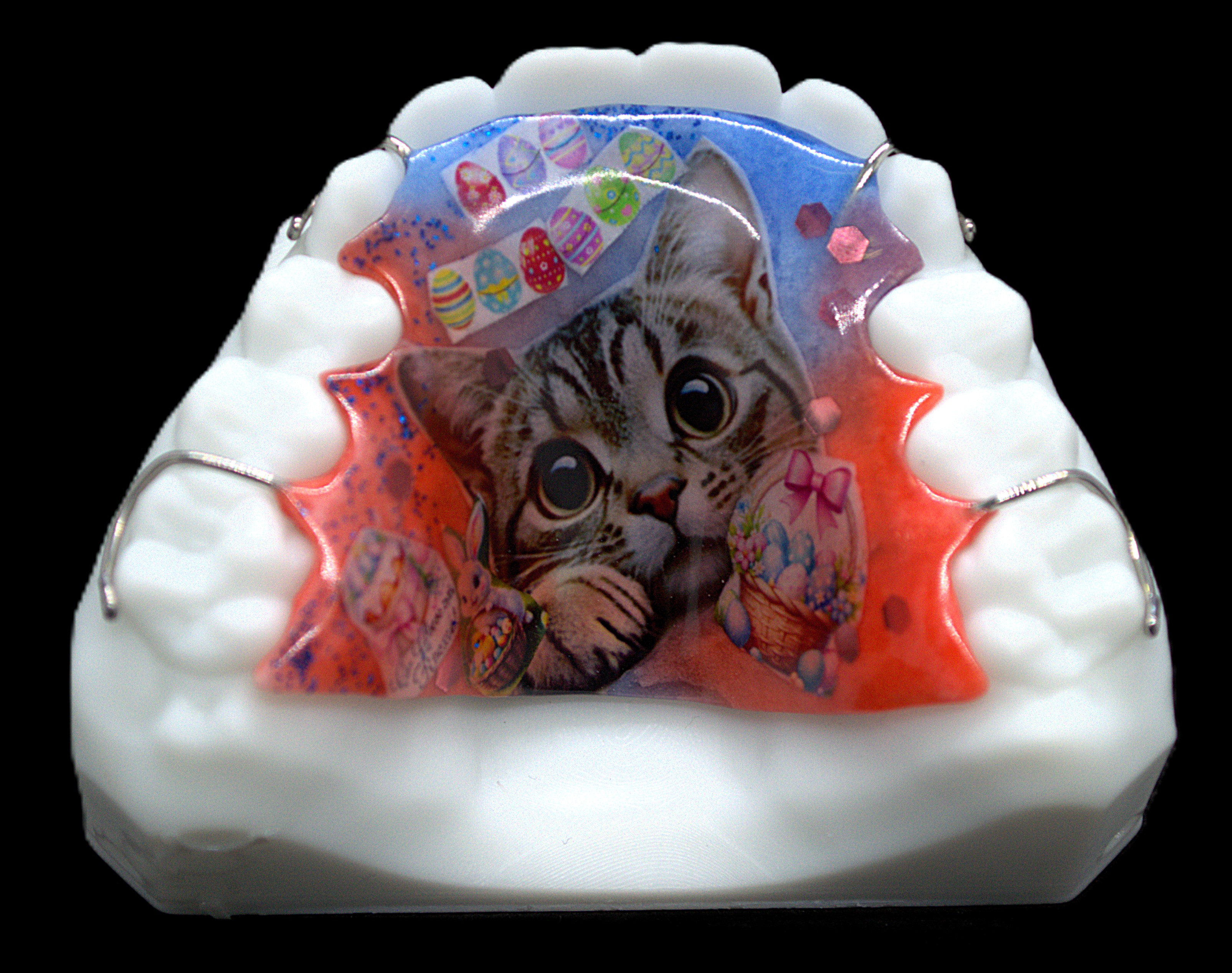 Ретенционный аппарат