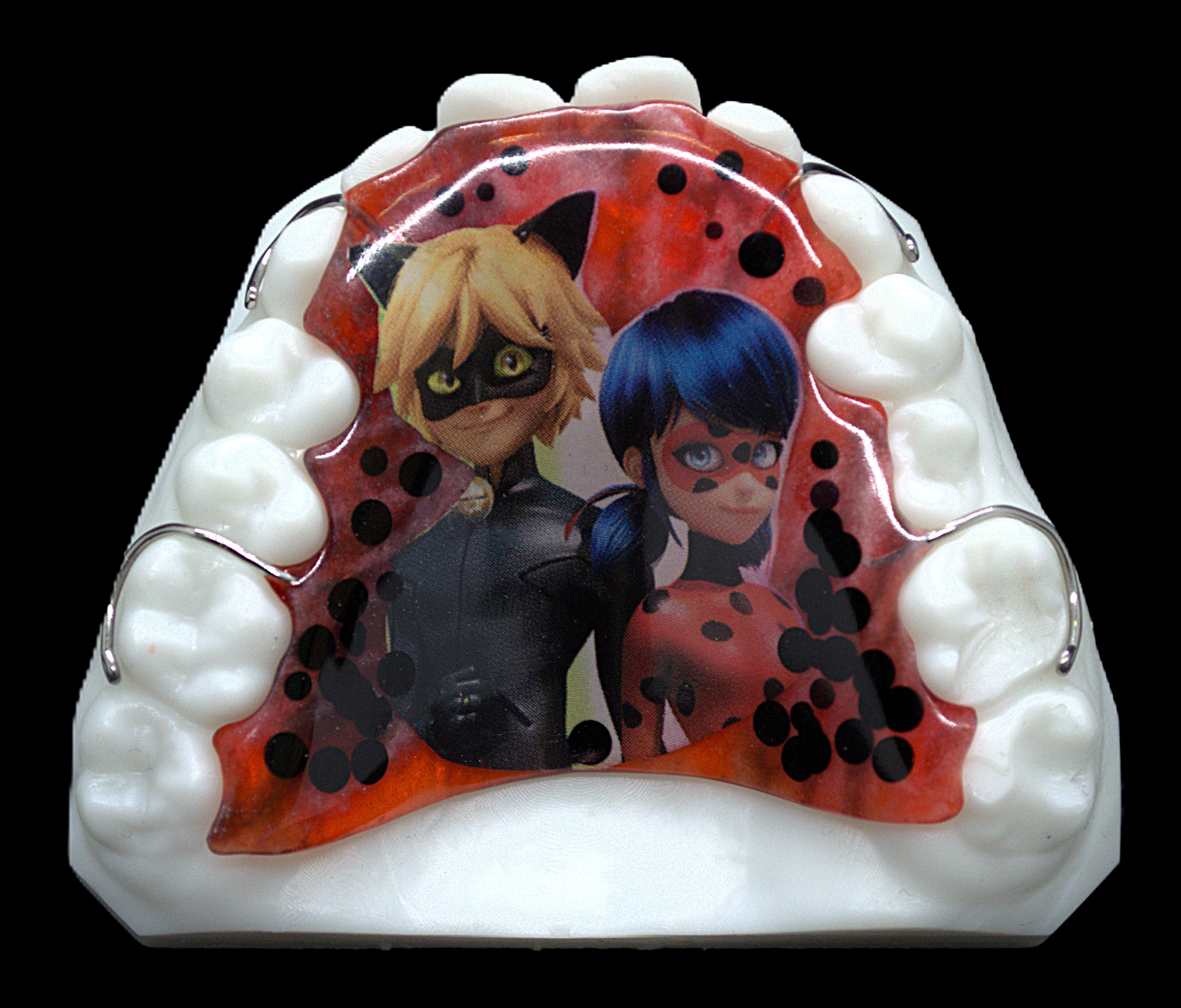 Ретенционный аппарат