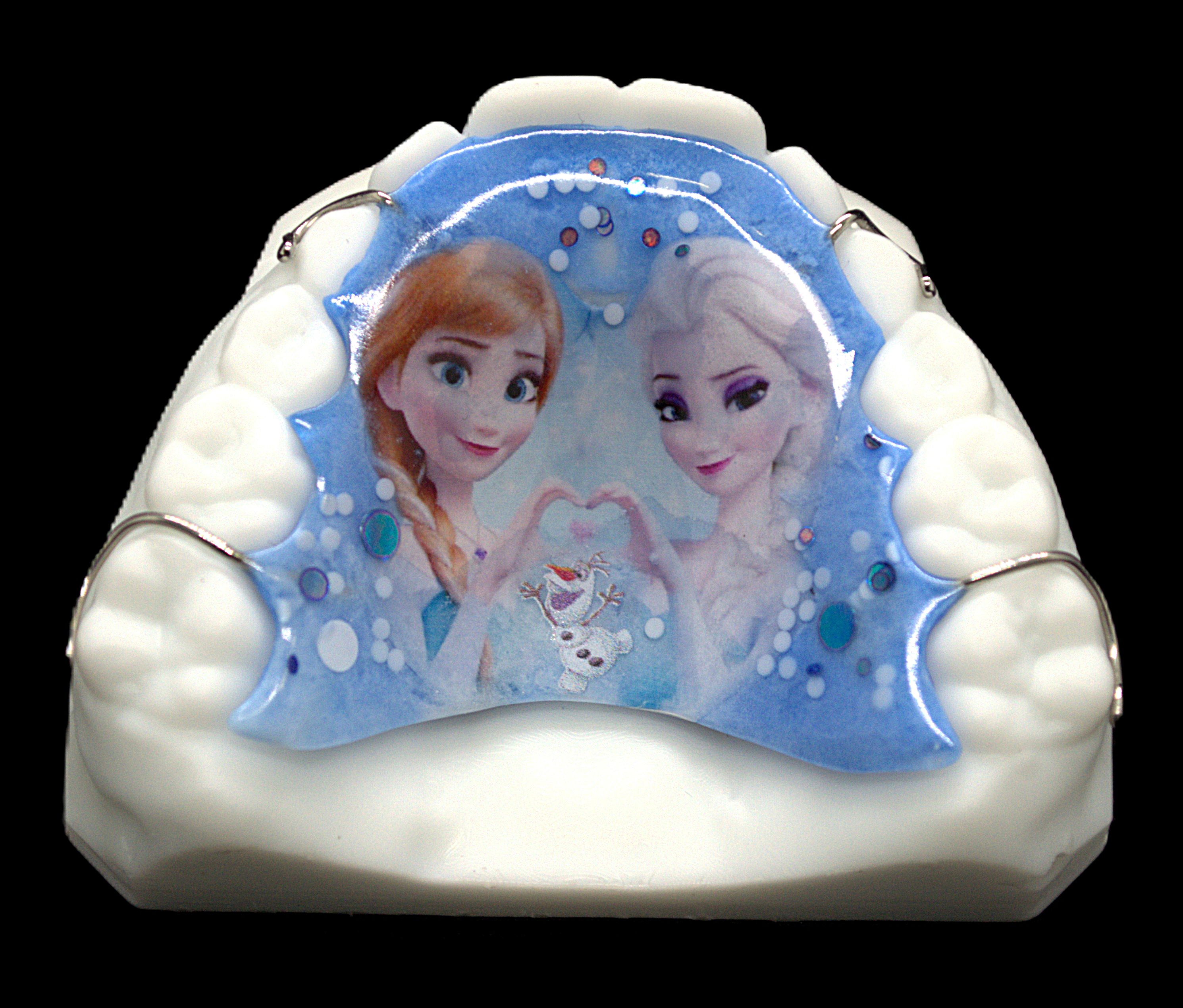 Ретенционный аппарат