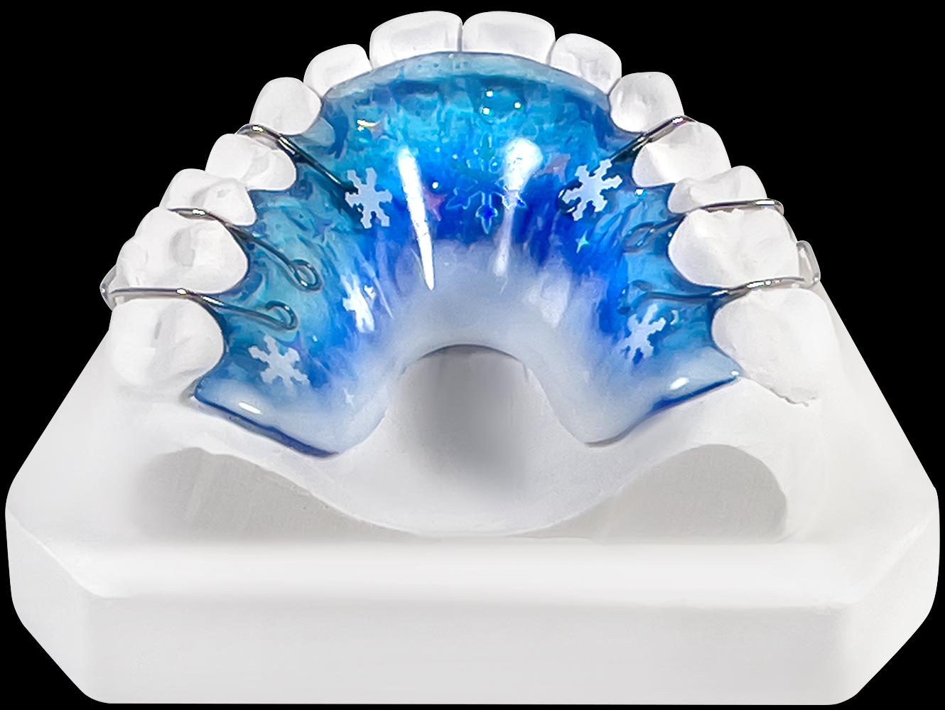 Ретенционный аппарат