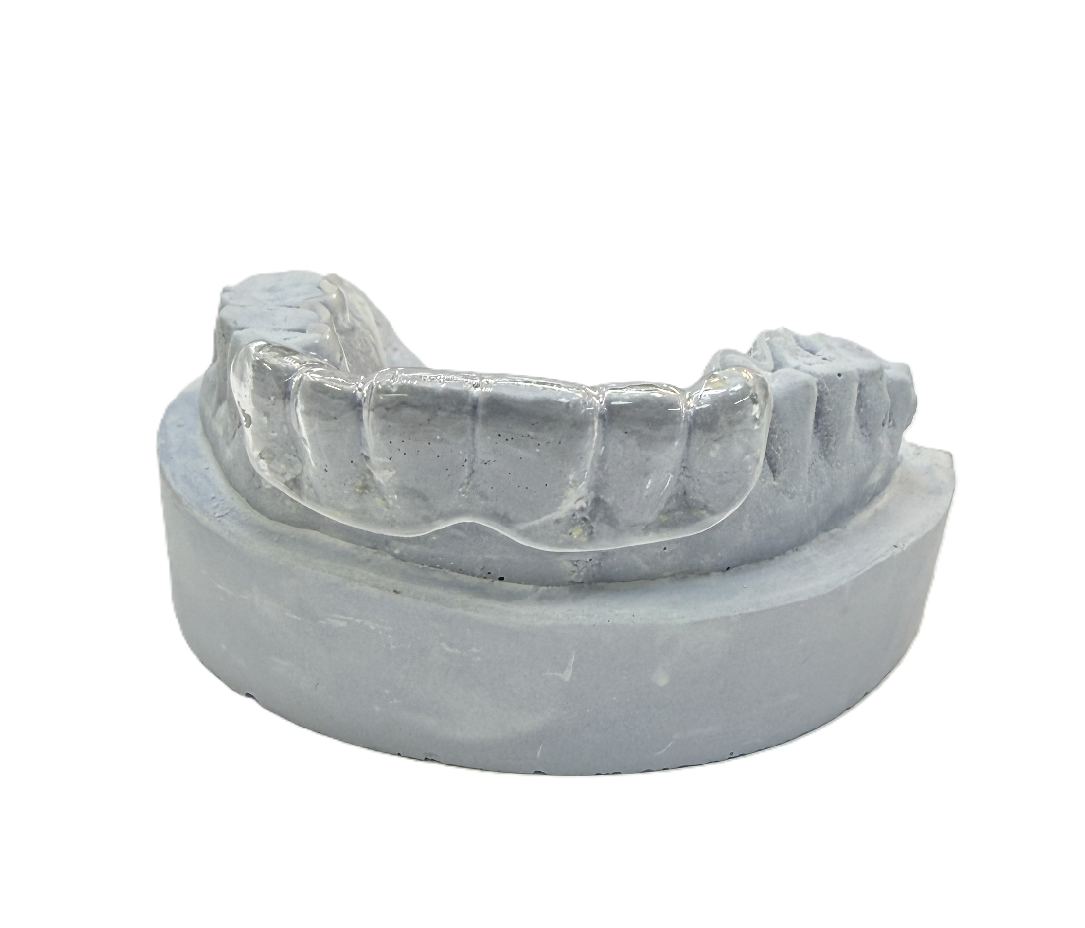 Дизайн ретенционной каппы